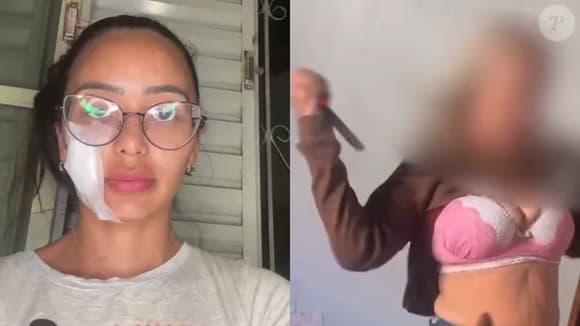 Ex-bailarina do Faustão é agredida com faca no rosto pela mãe