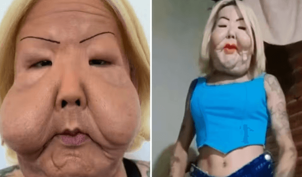 Juju do Pix mostra evolução do rosto depois de 50 dias da cirurgia para retirada de óleo