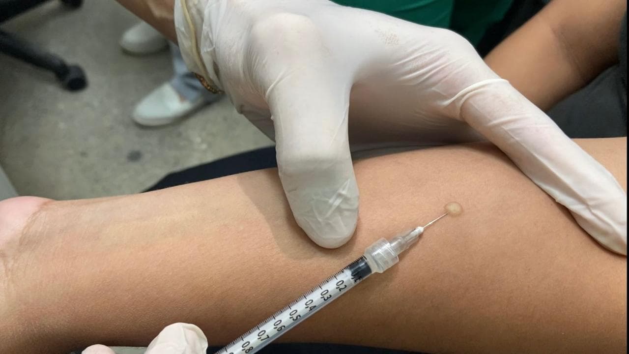 Manaus amplia oferta de teste preventivo contra tuberculose; confira